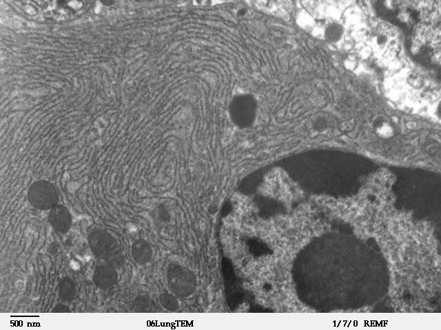 Faliste linie na tym zdjęciu są "retikulum endoplazmatycznym" komórki - magazynem na wapń. Receptory ryanodine znajdują się na tych strukturach.  