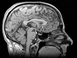 TRACK-HD użył silnego rezonansu magnetycznego aby uzyskać szczegółowe obrazy mózgów ochotników  