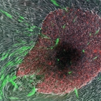 'Indukowane pluripotencjalne komórki macierzyste', na zielono i czerwono, wyrastają z otaczających komórek skóry  