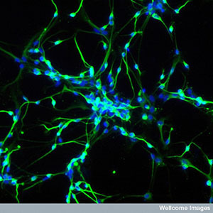 Komórki macierzyste można wykorzystać do hodowania neuronów w labolatorium. Takie neurony to doskonałe narzędzie badawcze chorób takich jak HD.  